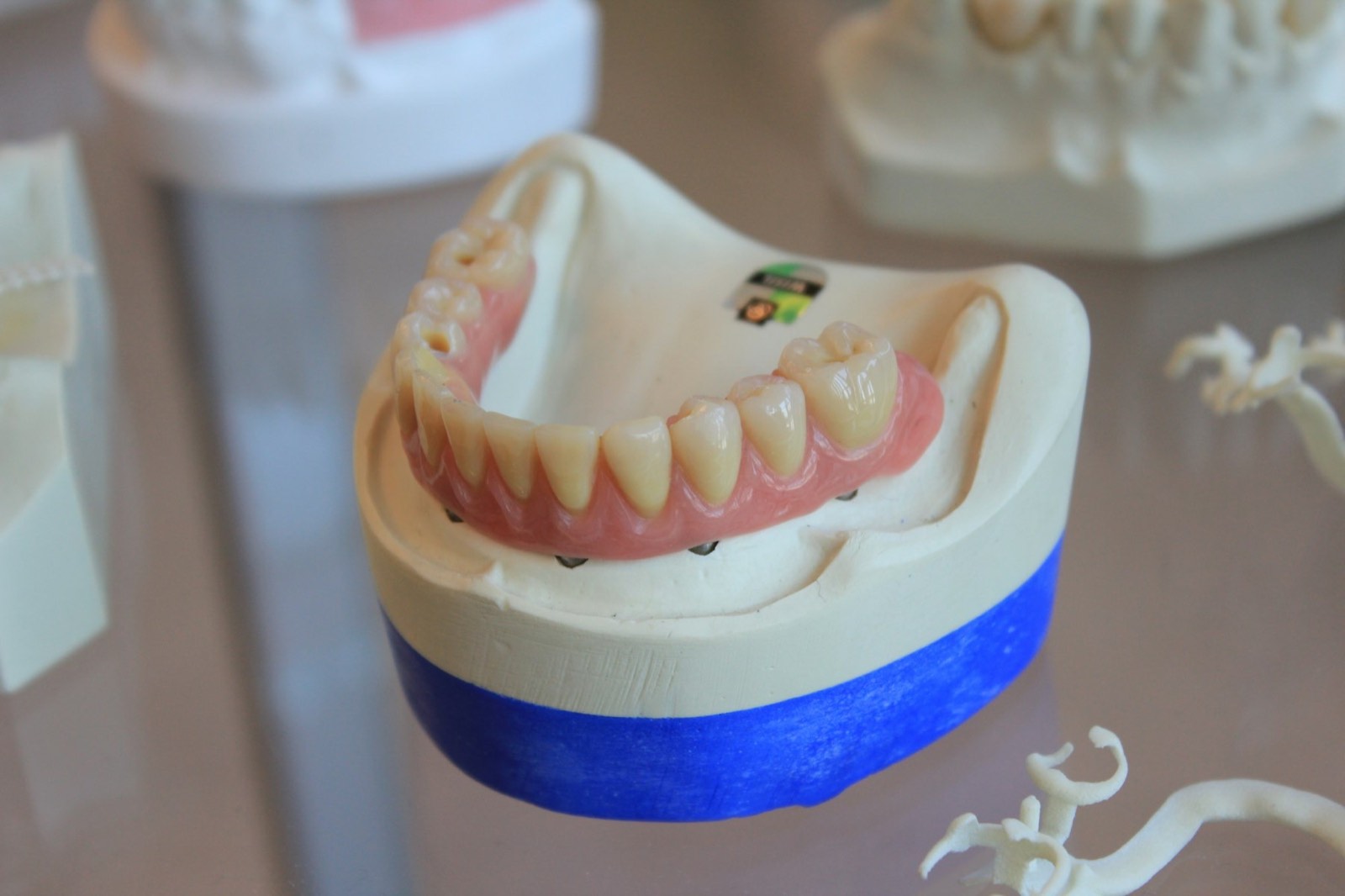 A denture on a dental model
